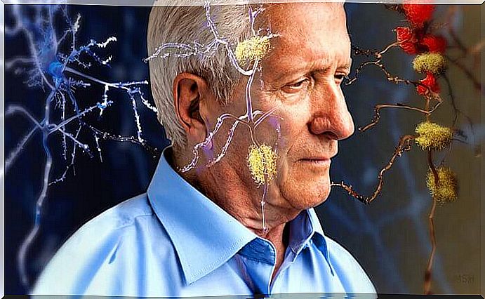 Man Suffering From Alzheimer's And Suffering From Memory Loss What This Is One Of The Alzheimer's Warning Signs